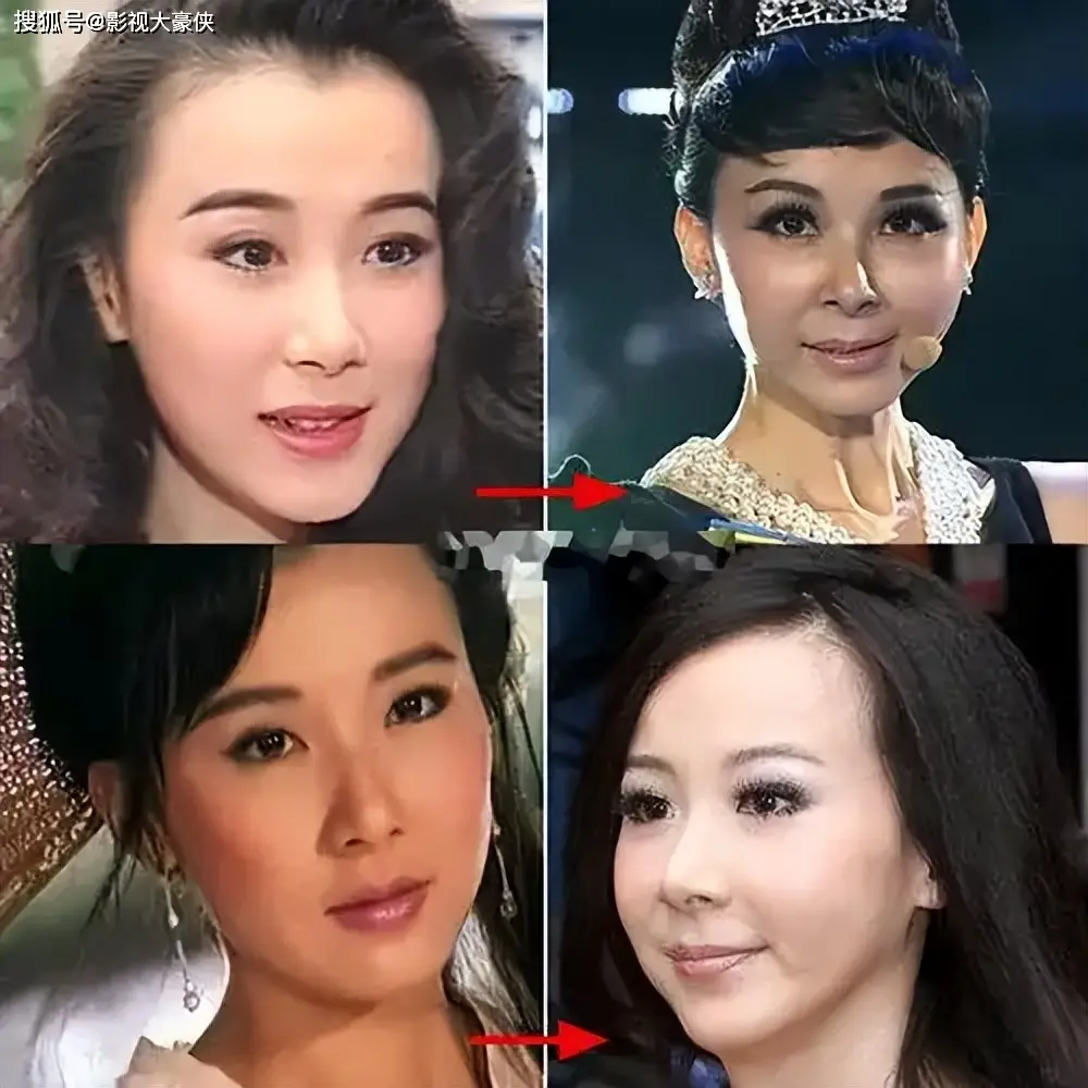_同人不同命，6位“琼女郎”：有人被骗800万，有人沉迷医美毁了容_同人不同命，6位“琼女郎”：有人被骗800万，有人沉迷医美毁了容