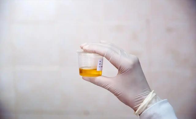 人活多久，看尿量就知道？老人尿量增加，越多越长寿？医生告诉你_人活多久，看尿量就知道？老人尿量增加，越多越长寿？医生告诉你_