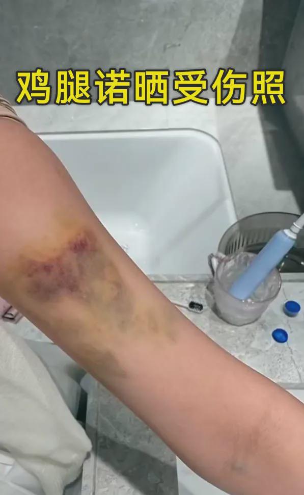 家暴or绿茶？程鑫凯和鸡腿诺，又双叒反转了__家暴or绿茶？程鑫凯和鸡腿诺，又双叒反转了