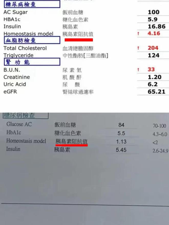 安怡长青糖尿病患者可以喝吗__糖尿病患者论坛