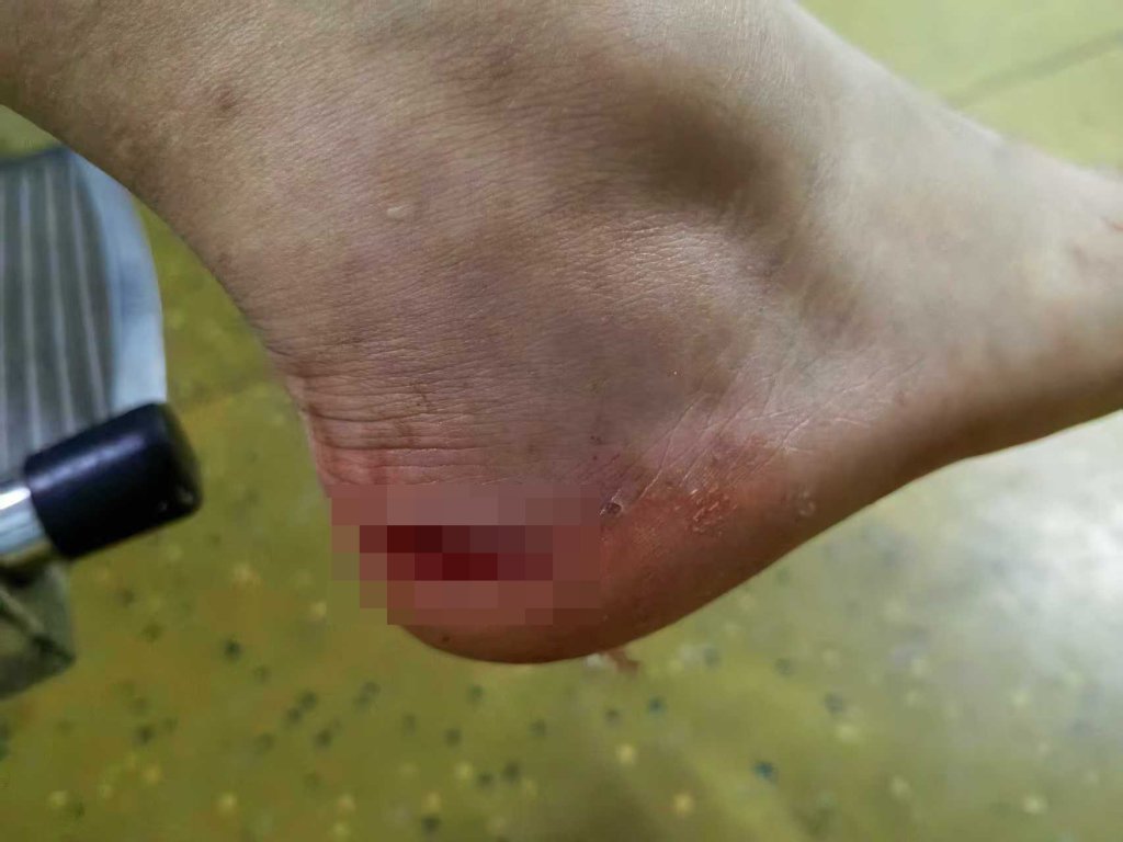 多名孩子在景区水池被瓷砖割伤，衡阳南岳文旅局：正沟通处理__多名孩子在景区水池被瓷砖割伤，衡阳南岳文旅局：正沟通处理