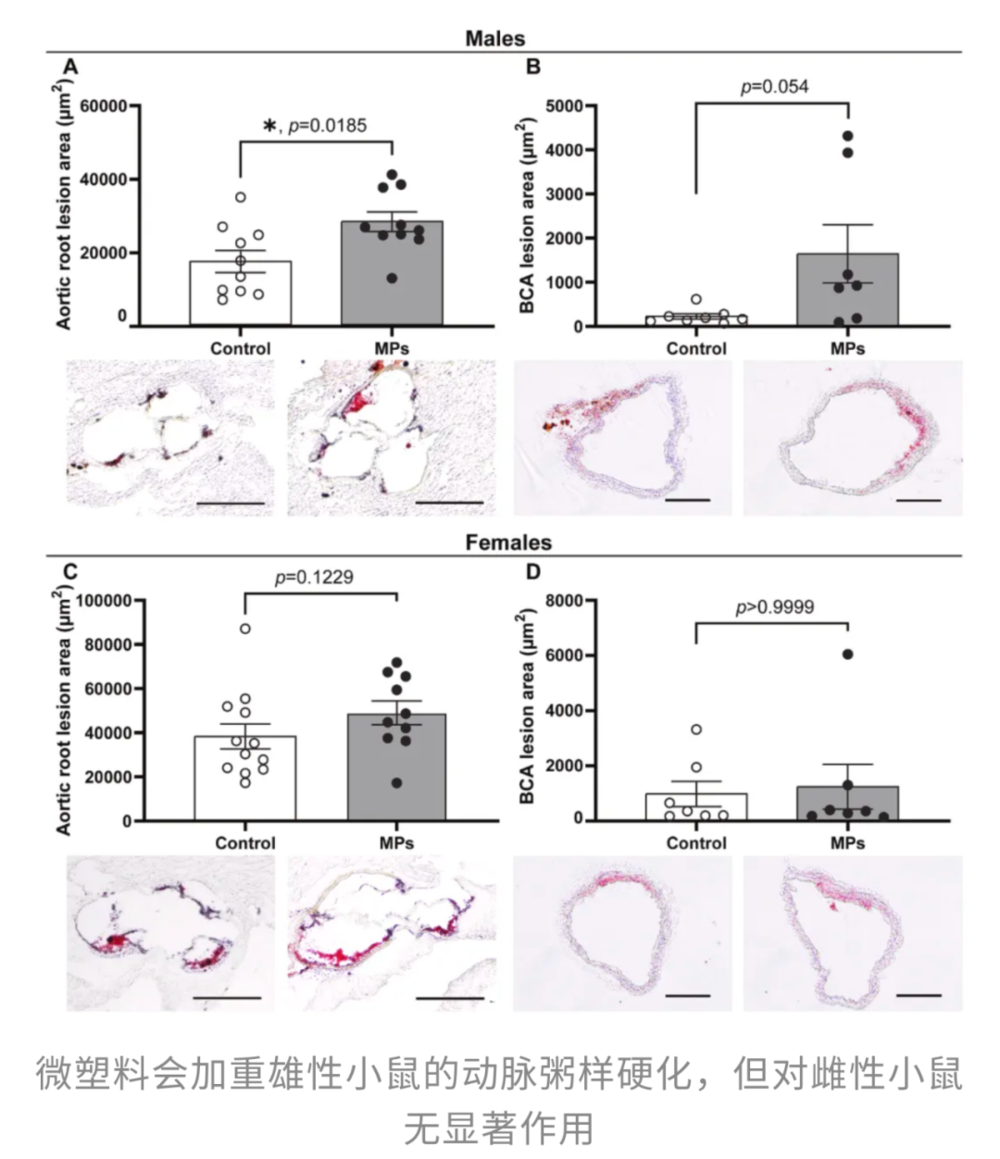 _每一口外卖、瓶装水都在伤害心脏和生育力,最新研究:微塑料不仅加剧动脉粥样硬化,还侵入男性生殖系统,不粘锅涂层竟成“帮凶”_每一口外卖、瓶装水都在伤害心脏和生育力,最新研究:微塑料不仅加剧动脉粥样硬化,还侵入男性生殖系统,不粘锅涂层竟成“帮凶”